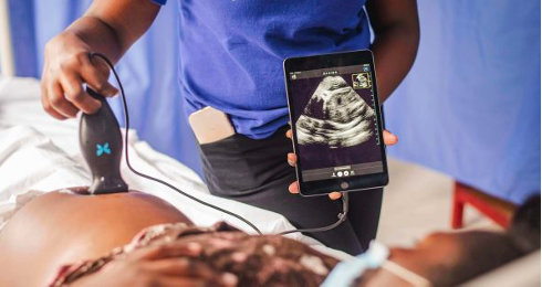 Butterfly Network Ultrasound